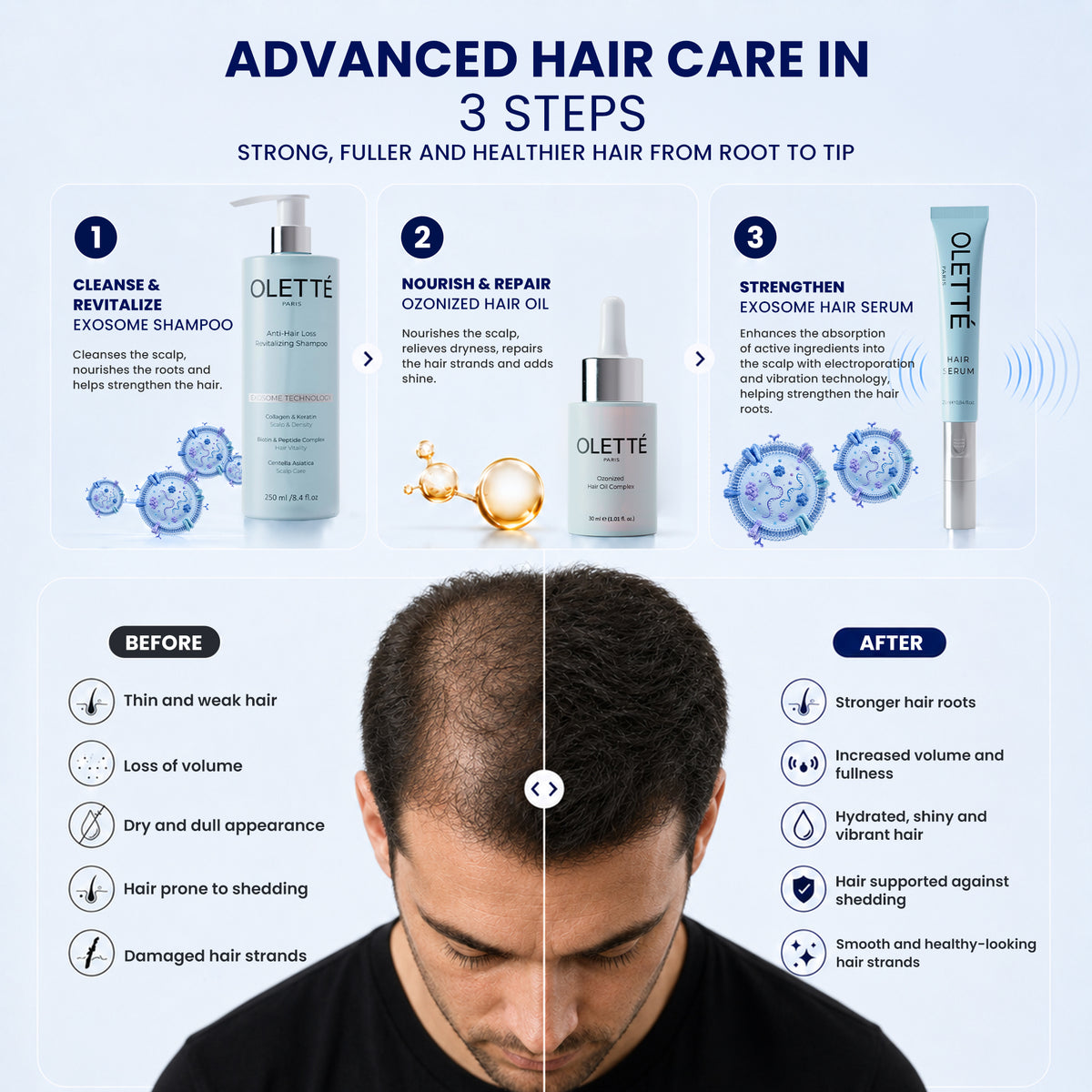 OLETTÉ PARIS 3-Step Hair Care Set